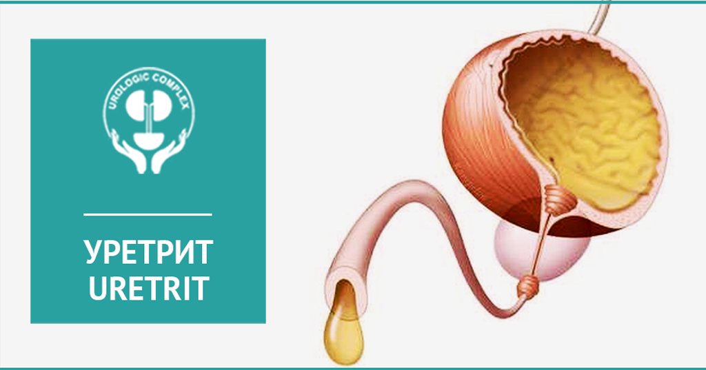 Uretrit / Uretrit