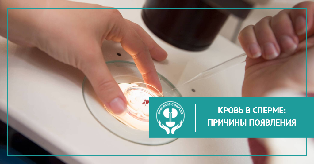 Кровь в сперме: причины появления
