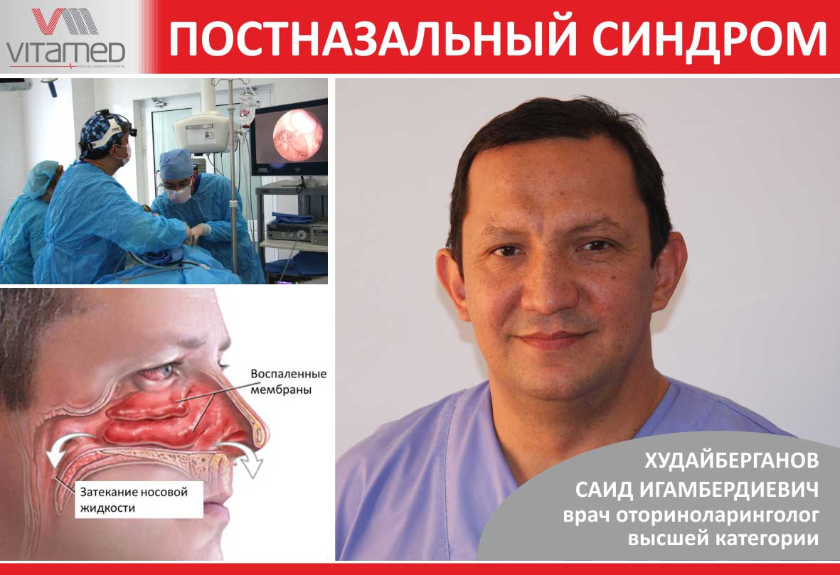 Синдром постназального затека (postnasal drip syndrom)