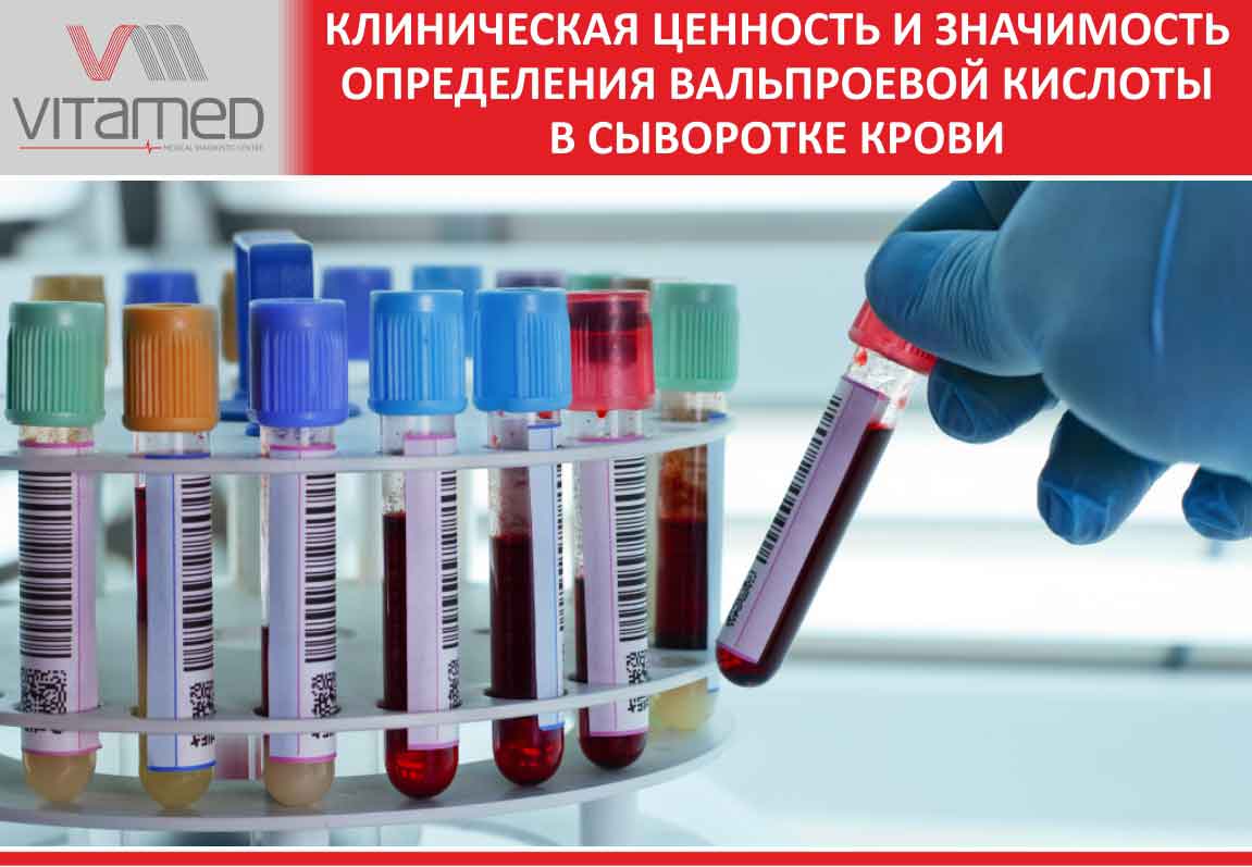 Клиническая ценность и значимость определения вальпроевой кислоты в сыворотке крови.