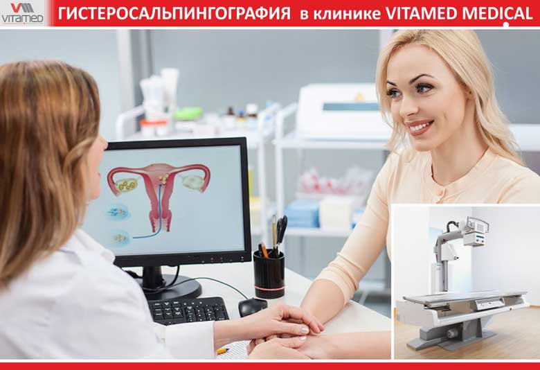 Гистеросальпингография  в клинике VITAMED MEDICAL