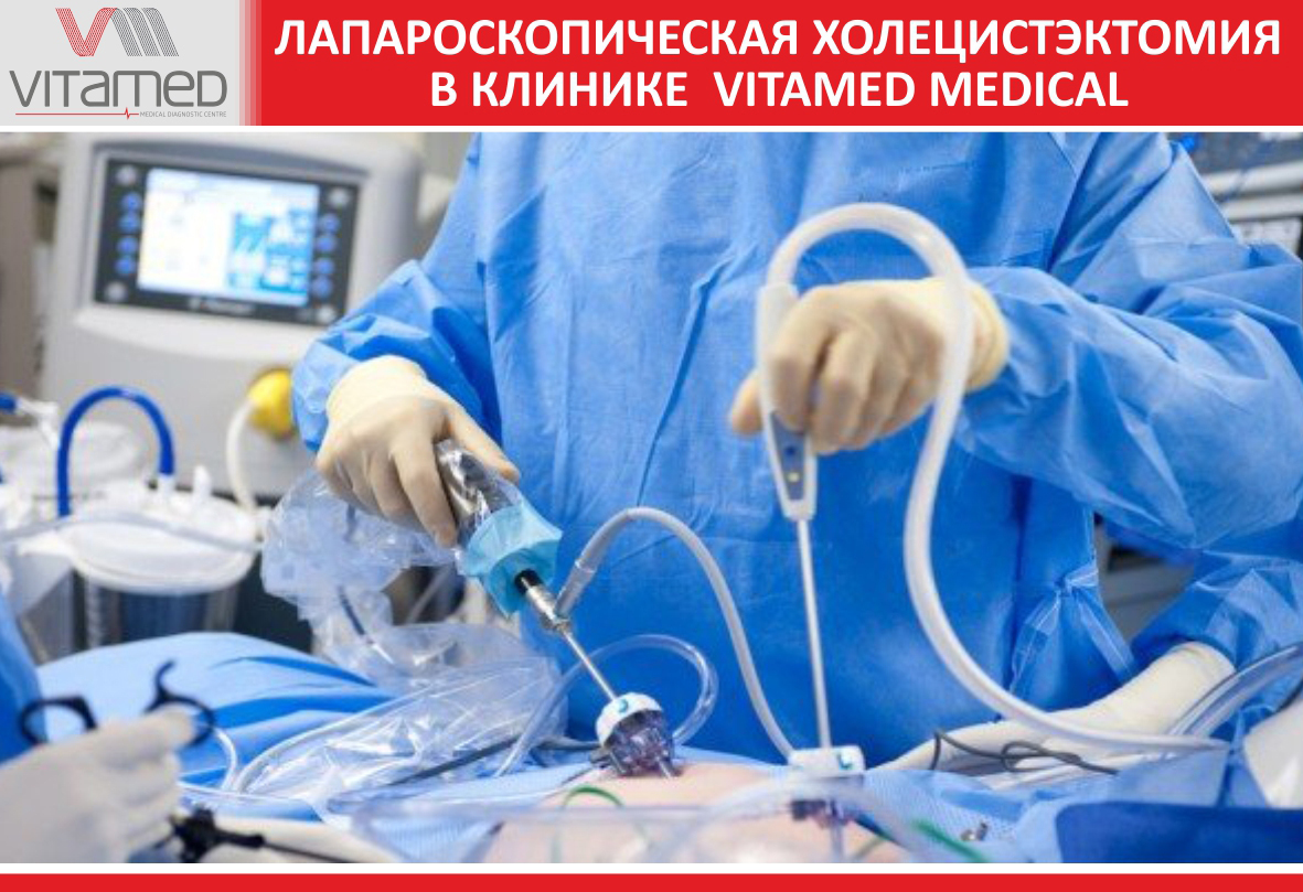 Лапароскопическая холецистэктомия в клинике  VITAMED MEDICAL