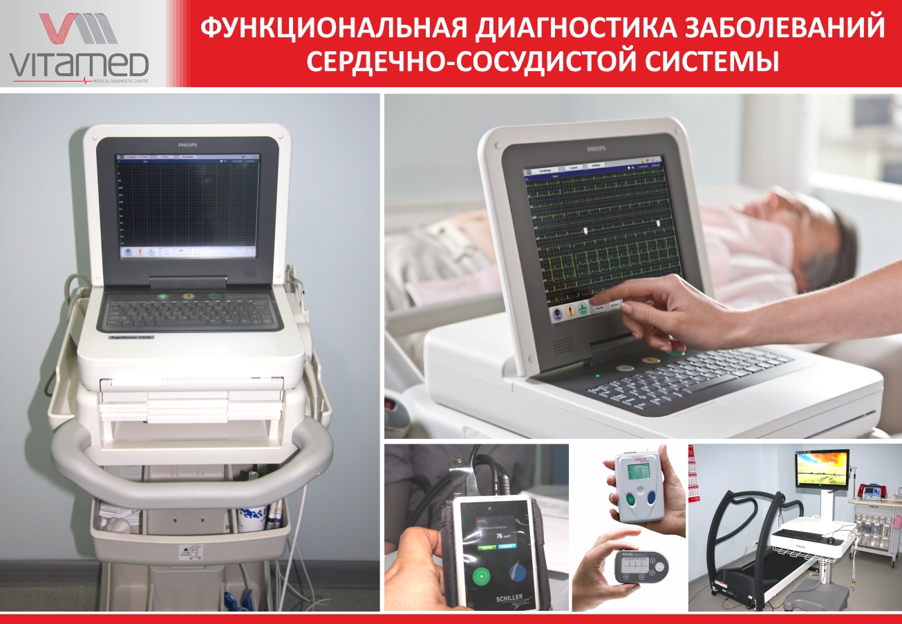 Методы функциональной диагностики заболеваний сердечно-сосудистой системы в клинике Vitamed Medical